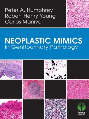 cover image of Neoplastic Mimics in Genitourinary Pathology